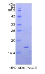 Human SIGLEC1 / CD169 / Sialoadhesin Protein (Recombinant His)