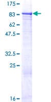 Human ZNF599 Protein (Recombinant GST)