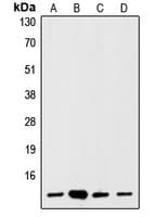 IHC-plus™ Polyclonal Rabbit anti-Human S100A1 / S100-A1 Antibody (N-Terminus, IHC, IF, WB)