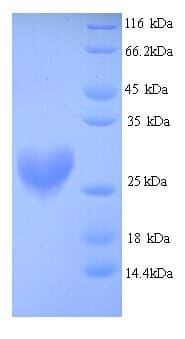 Mouse NQO2 Protein (Recombinant His)