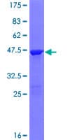 Human PPP1R27 / DYSFIP1 Protein (Recombinant GST)
