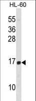 Polyclonal Rabbit anti-Human HIST1H2BD Antibody (aa1-30, WB)
