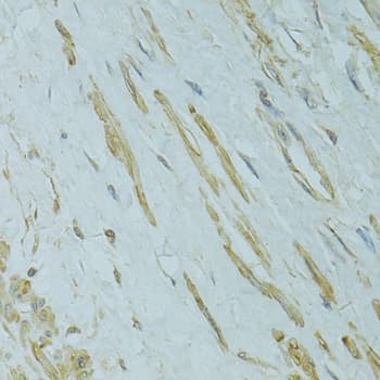 IFT57 / HIPPI Antibody