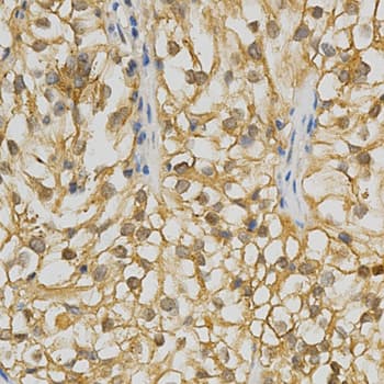 Polyclonal Rabbit anti-Human ADRBK2 / GRK3 Antibody (IHC, WB)
