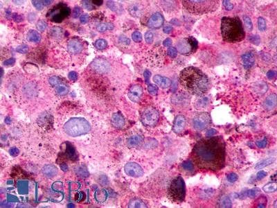 PathPlus™ Polyclonal Rabbit anti-Human CX3CR1 Antibody (Extracellular Domain, IHC)