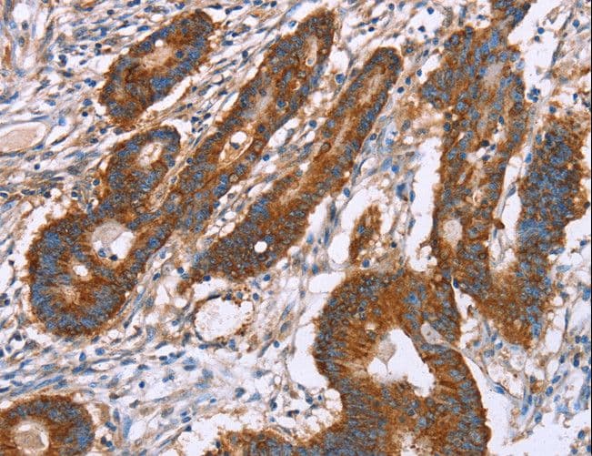 PDLIM1 Antibody