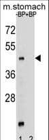 Polyclonal Rabbit anti-Human FKSG89 / MBOAT4 Antibody (aa258-287, IHC, WB)