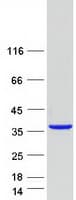 Human FAM151B Protein (Recombinant Myc-DDK (Flag))