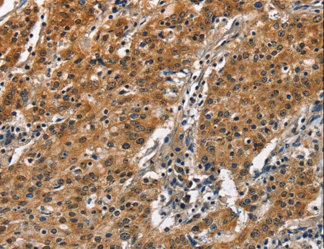 SLAMF8 Antibody