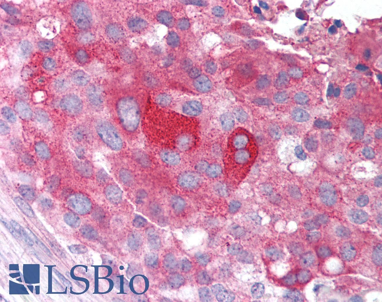 POU5F1 / OCT4 Antibody (Internal, Biotin)
