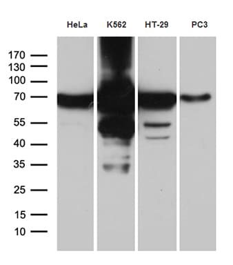 IMP-3 / IGF2BP3 Antibody (clone OTI7B10)