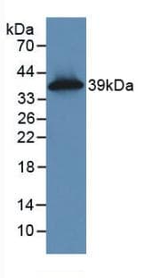 KRT16 / CK16 / Cytokeratin 16 Antibody (aa117-419)