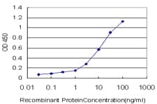 Monoclonal Mouse anti-Human RORB / ROR Beta Antibody (clone 4B4, WB)