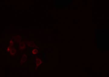 DGK-IOTA / DGKI Antibody