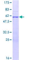 Human RPL7L1 Protein (Recombinant GST)