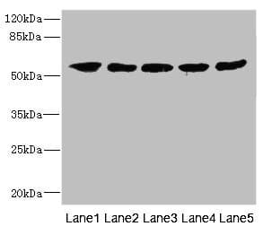 CRF2-12 / IL28RA Antibody