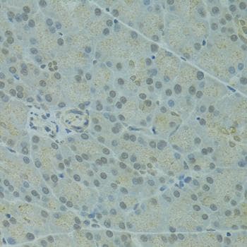 Polyclonal Rabbit anti-Human IVNS1ABP / NS1-BP Antibody (IHC)
