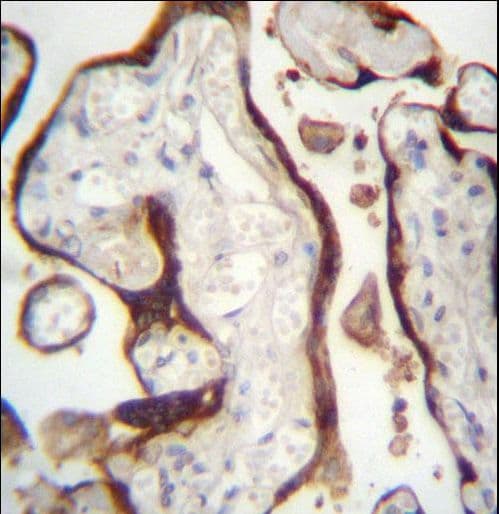 CSHL1 / CSH-Like 1 Antibody (aa156-185)