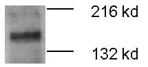 IHC-plus™ Polyclonal Rabbit anti-Human WC1 / ATP7B Antibody (N-Terminus, IHC, WB)