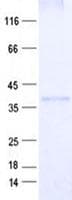 Human C3orf70 Protein (Recombinant His, N-Terminal)