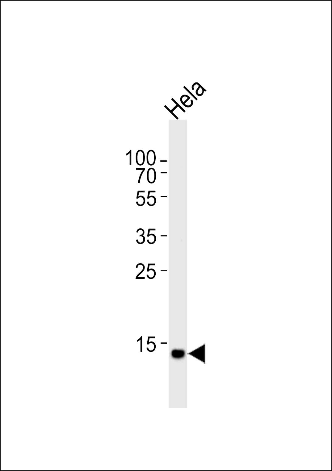 Polyclonal Rabbit anti-Human UBE2D2 / UBCH5B Antibody (aa112-140, WB)