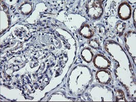 DNM1L / DRP1 Antibody (clone OTI3F4)