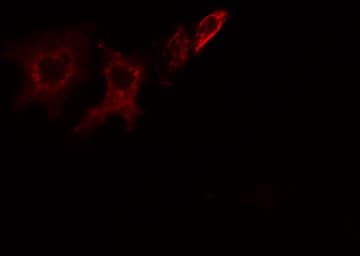Polyclonal Rabbit anti-Human ITPK1 Antibody (IF, WB)