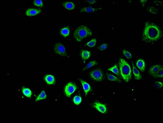 Polyclonal Rabbit anti-Human ATG14 Antibody (IHC, IF)