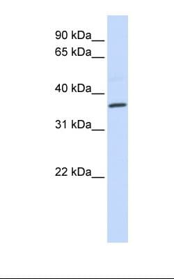 CCR5 Antibody (aa180-229)