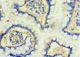 Polyclonal Rabbit anti-Human PKD2L1 Antibody (aa561-805, IHC)