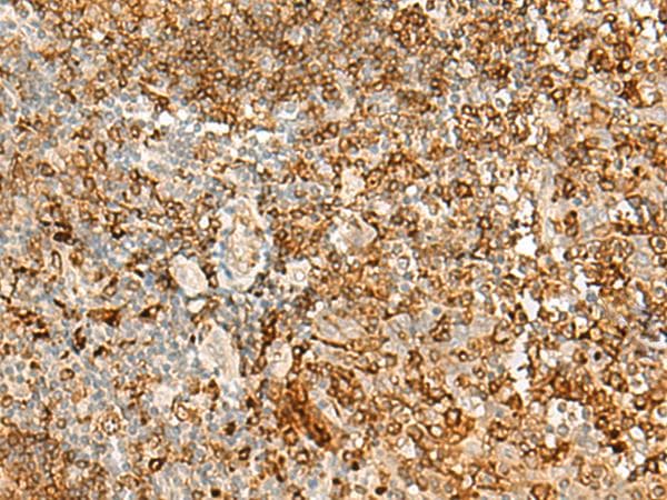 Polyclonal Rabbit anti-Human HLA-DRB1 Antibody (IHC)