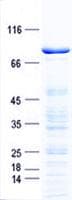 Human CLIP3 Protein (Recombinant GST, N-terminus + His, C-terminus)