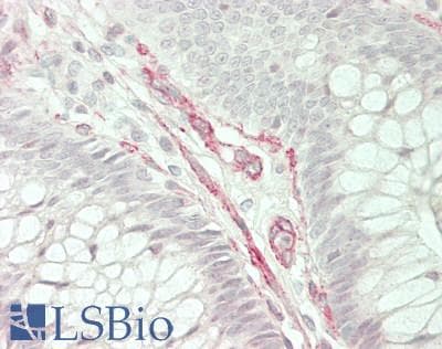 IHC-plus™ AQP5 / Aquaporin 5 Antibody (aa227-256)