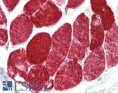 Cardiolipin Synthase / CRLS1 Antibody (aa107-156)