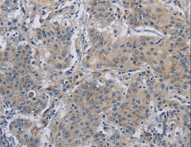 DNAJB4 Antibody