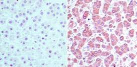 CRABP2 Antibody (aa75-125)