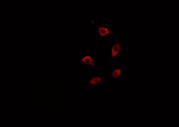 Polyclonal Rabbit anti-Human TMEPAI / PMEPA1 Antibody (IHC, IF, WB)