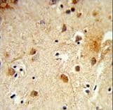 CBY1 / PGEA1 Antibody (aa98-126)