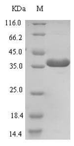 Human ZNRF3 Protein (Recombinant 6His-SUMO, N-terminus)