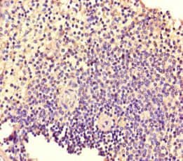 Polyclonal Rabbit anti-Human TIAM1 Antibody (IHC, IF)