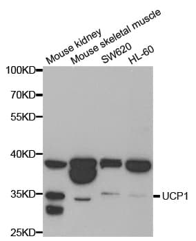 UCP1 / UCP-1 Antibody