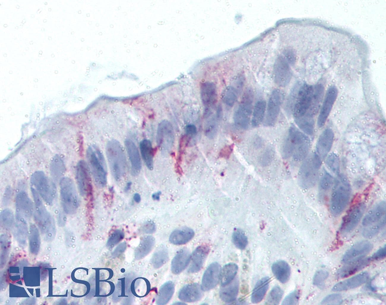PathPlus™ Polyclonal Rabbit anti-Human GPR49 / LGR5 Antibody (Cytoplasmic Domain, IHC)