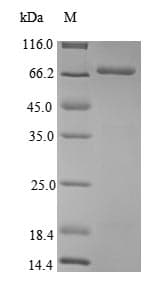Agrobacterium tumefaciens virE2 Protein (Recombinant 10His, N-terminus + Myc, C-terminus)