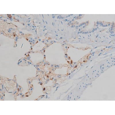MAPK3 / ERK1 Antibody (phospho-Tyr204,pThr202)