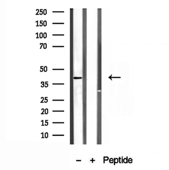 Polyclonal Rabbit anti-Human PSAT1 Antibody (IHC, IF, WB)