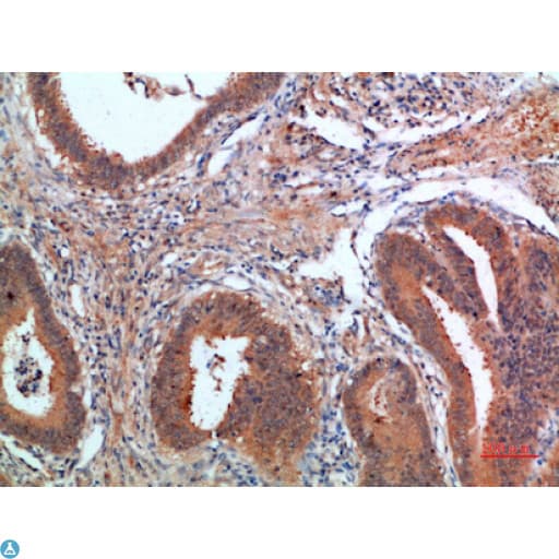 Polyclonal Rabbit anti-Human PDGF-CC Antibody (IHC)