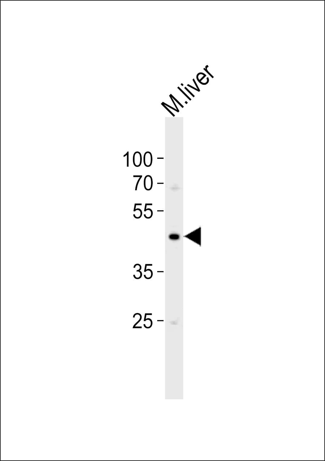 c-Src Kinase / CSK Antibody (aa67-101)