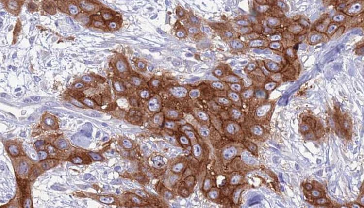 GNA15 Antibody