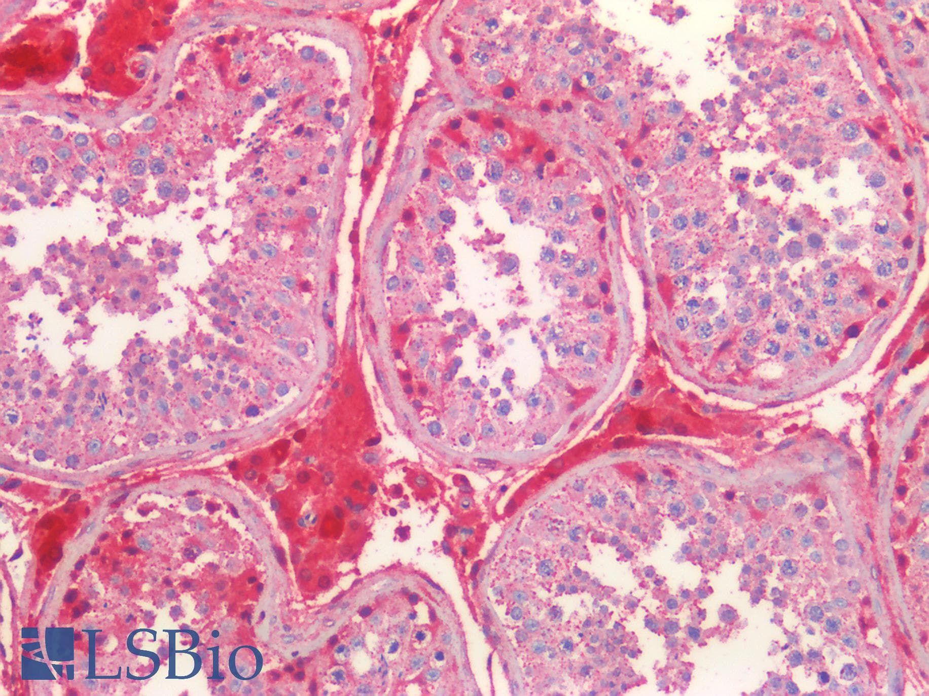 Polyclonal Rabbit anti-Human S100A6 / Calcyclin Antibody (aa1-90, IHC, WB)