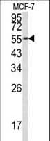 Polyclonal Rabbit anti-Human EEF1A1 Antibody (aa361-389, IHC, IF, WB)